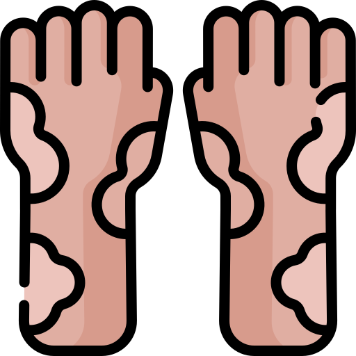 eczema
