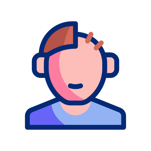 hair-transplant