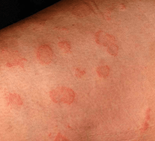skin Allegry 4